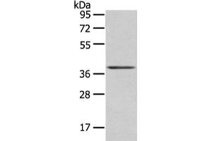 Gel: 8 % SDS-PAGE, Lysate: 40 μg, Lane: Mouse brain tissue, Primary antibody: ABIN7193059(WNT10A Antibody) at dilution 1/200 dilution, Secondary antibody: Goat anti rabbit IgG at 1/8000 dilution, Exposure time: 10 seconds (Protein Wnt-1 (WNT1.L) antibody)