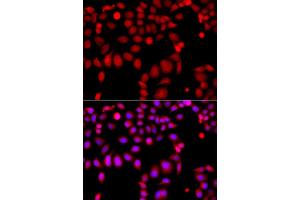 Immunofluorescence analysis of A549 cell using ARHGEF9 antibody. (Arhgef9 antibody)