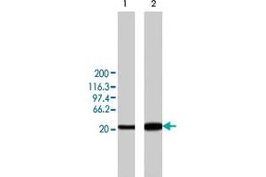Western blot analysis of min6 cells overexpressing rat Camk2d, using Camk2d polyclonal antibody . (CAMK2D antibody)
