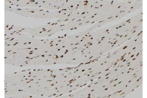 ABIN6277568 at 1/100 staining Mouse heart tissue by IHC-P. (FBP1 antibody  (Internal Region))