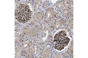 Immunohistochemical staining of human kidney with IL17RE polyclonal antibody  shows strong cytoplasmic and membranous positivity in glomeruli at 1:50-1:200 dilution.