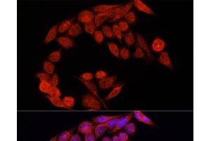 Immunofluorescence analysis of HeLa cells using NRF2 Polyclonal Antibody at dilution of 1:100. (NRF2 antibody)