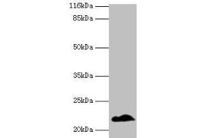 Western blot All lanes: NDUFB5 antibody at 2 μg/mL + U251 whole cell lysate Secondary Goat polyclonal to rabbit IgG at 1/10000 dilution Predicted band size: 22, 16 kDa Observed band size: 22 kDa (NDUFB5 antibody  (AA 94-189))