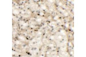 Immunohistochemistry (IHC) image for anti-NK2 Homeobox 6 (NKX2-6) (Middle Region) antibody (ABIN1031022) (NKX2-6 antibody  (Middle Region))