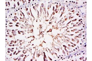 Paraformaldehyde-fixed, paraffin embedded rat testis, Antigen retrieval by boiling in sodium citrate buffer (pH6) for 15min, Block endogenous peroxidase by 3% hydrogen peroxide for 30 minutes, Blocking buffer (normal goat serum) at 37°C for 20min, Antibody incubation with Rabbit Anti-FAM29A Polyclonal Antibody, Unconjugated (C at 1:500 overnight at 4°C, followed by a conjugated secondary for 90 minutes and DAB staining (FAM29A antibody)