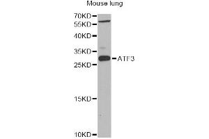 Western blot analysis of extracts of mouse lung, using ATF3 Antibody (ABIN1871129) at 1:1000 dilution. (ATF3 antibody)