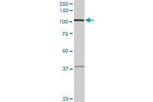 FLJ20097 monoclonal antibody (M01A), clone 2D11. (Syndetin/VPS50 antibody  (AA 862-964))