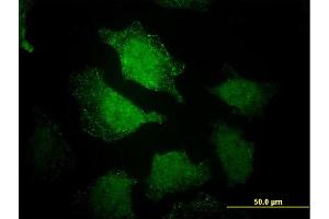 Immunofluorescence of monoclonal antibody to EHD3 on HeLa cell.