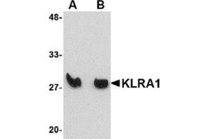 Western blot analysis of KLRA1 in mouse spleen tissue lysate with KLRA1 antibody at (A) 1 μg/ml and (B) 2 μg/ml. (KLRA1 antibody  (Center))