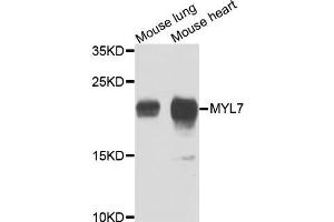 Western blot analysis of extracts of mouse lung and mouse heart cells, using MYL7 antibody. (MYL7 antibody)