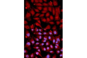 Immunofluorescence analysis of U2OS cells using MAP2K6 antibody (ABIN5971400). (MAP2K6 antibody)