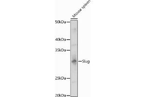 Western blot analysis of extracts of Mouse spleen, using Slug antibody (ABIN3021317, ABIN3021318, ABIN3021319 and ABIN6214866) at 1:1000 dilution.