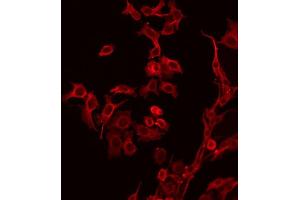 ABIN6267392 staining Hela by IF/ICC. (CD19 antibody  (pTyr531))