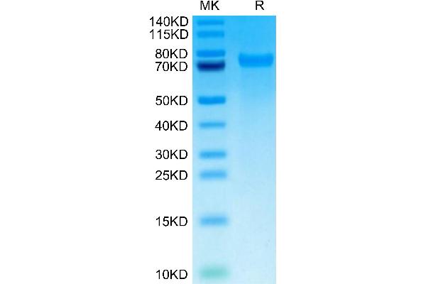 TNC Protein (AA 23-621) (His tag)
