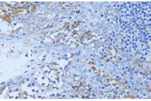 Immunohistochemistry of paraffin-embedded Human tonsil using HADH Polyclonal Antibody at dilution of 1:100 (40x lens). (HADH antibody)