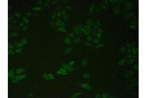 Detection of PDIA4 in Human Hela Cells using Polyclonal Antibody to Protein Disulfide Isomerase A4 (PDIA4) (PDIA4 antibody  (AA 505-636))
