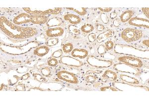 Detection of ACO1 in Human Kidney Tissue using Polyclonal Antibody to Aconitase 1 (ACO1) (Aconitase 1 antibody  (AA 26-243))