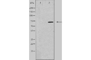 Western blot analysis of extracts from Jurkat cells, using DYR1B antibody. (DYRK1B antibody  (Internal Region))