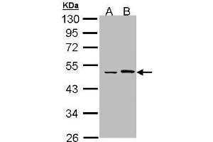WB Image Sample (30 ug of whole cell lysate) A: Hela B: Hep G2 , 10% SDS PAGE antibody diluted at 1:1000