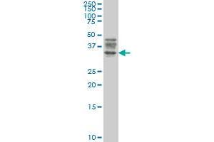 ATG3 monoclonal antibody (M06), clone 1F7 Western Blot analysis of ATG3 expression in Jurkat . (ATG3 antibody  (AA 1-100))