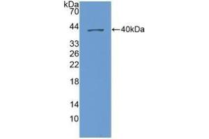 Detection of Recombinant NAP3, Human using Polyclonal Antibody to Chemokine (C-X-C Motif) Ligand 1 (CXCL1) (CXCL1 antibody  (AA 35-107))