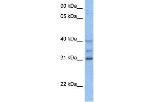 WB Suggested Anti-HOXD1 Antibody Titration:  0. (HOXD1 antibody  (C-Term))