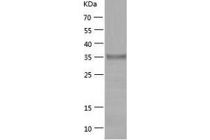 Western Blotting (WB) image for Zinc Finger and BTB Domain Containing 24 (ZBTB24) (AA 1-365) protein (His tag) (ABIN7125766) (ZBTB24 Protein (AA 1-365) (His tag))