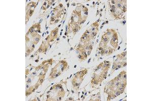 Immunohistochemistry (IHC) image for anti-Cell Division Cycle 34 (CDC34) antibody (ABIN1876645) (CDC34 antibody)