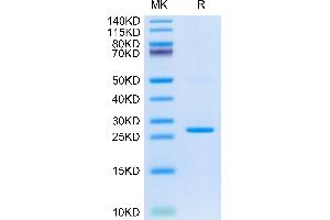 CRP Protein (AA 19-224) (His tag)