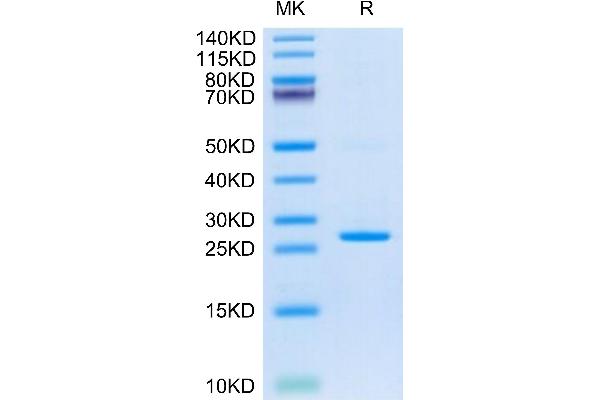 CRP Protein (AA 19-224) (His tag)