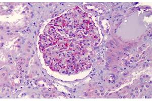 Human Kidney: Formalin-Fixed, Paraffin-Embedded (FFPE) (NLRP3 antibody)