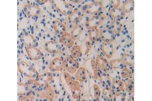 IHC-P analysis of Kidney tissue, with DAB staining. (CISH antibody  (AA 79-256))