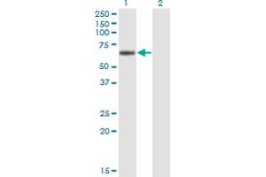 Western Blot analysis of LIPG expression in transfected 293T cell line by LIPG monoclonal antibody (M01), clone 4A9. (LIPG antibody  (AA 21-500))