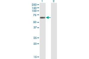 Western Blot analysis of LIPG expression in transfected 293T cell line by LIPG monoclonal antibody (M01), clone 4A9.