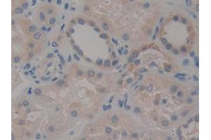 DAB staining on IHC-P; Samples: Human Kidney Tissue (STAT2 antibody  (AA 616-849))