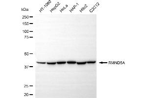 anti-Required For Meiotic Nuclear Division 5 Homolog A (RMND5A) antibody