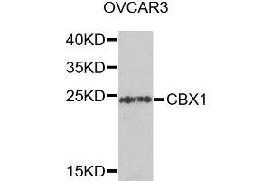 Western blot analysis of extracts of OVCAR3 cells, using CBX1 antibody.