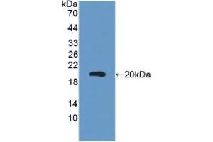 Detection of Recombinant CEA, Mouse using Polyclonal Antibody to Carcinoembryonic Antigen (CEA) (CEA antibody  (AA 544-771))
