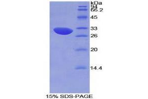 SDS-PAGE (SDS) image for Complement Factor H (CFH) (AA 915-1156) protein (His tag) (ABIN2124473)