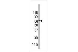 Image no. 1 for anti-Peptidyl Arginine Deiminase, Type IV (PADI4) (C-Term) antibody (ABIN357799) (PAD4 antibody  (C-Term))