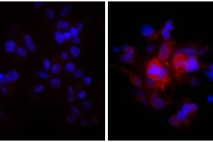 Human hepatocellular carcinoma cell line Hep G2 was stained with Rabbit Anti-Human DR5-UNLB and DAPI. (Donkey anti-Rabbit IgG (Heavy & Light Chain) Antibody (HRP) - Preadsorbed)
