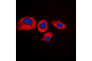Immunofluorescent analysis of RPS4Y1 staining in K562 cells. (RPS4Y1 antibody  (C-Term))