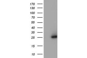 HEK293T cells were transfected with the pCMV6-ENTRY control (Left lane) or pCMV6-ENTRY NQO2 (Right lane) cDNA for 48 hrs and lysed. (NQO2 antibody)