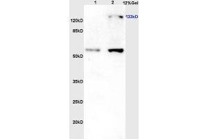 Lane 1: Rat brain lysates; Lane 2: Rat liver lysates probed with Rabbit Anti-eNOS (Thr113) Polyclonal Antibody (ABIN701245) at 1:300 overnight in 4 °C. (ENOS antibody  (pThr113))