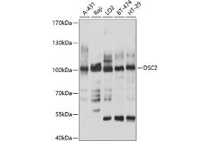 Western blot analysis of extracts of various cell lines, using DSC2 antibody (ABIN6127802, ABIN6139827, ABIN6139828 and ABIN6214372) at 1:1000 dilution.