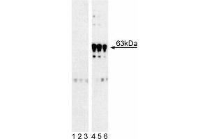 Western blot analysis of PDPK1 (pS241) in human T lymphocytes. (PDPK1 antibody  (pSer241))