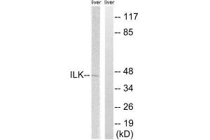 Western Blotting (WB) image for anti-Integrin-Linked Kinase (ILK) (Ser246) antibody (ABIN1848218) (ILK antibody  (Ser246))