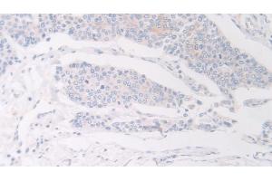 Immunohistochemistry (IHC) image for anti-Flightless I Homolog (FLII) (AA 896-1176) antibody (ABIN7436756)