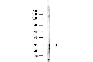 anti-Taste Receptor, Type 2, Member 38 (TAS2R38) (Internal Region) antibody