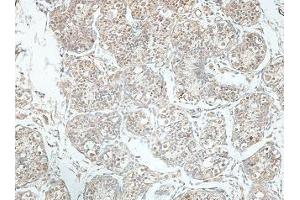 IHC analysis of formalin-fixed paraffin-embedded fetal testis, using ORM2 antibody (1/100 dilution).